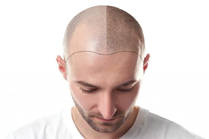 Scalp Tattoo