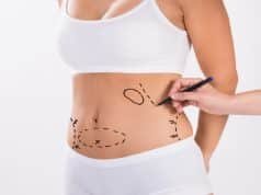 Effortless Elegance: Achieve Your Ideal Silhouette with Liposuction in Turkey Liposuction in Turkey