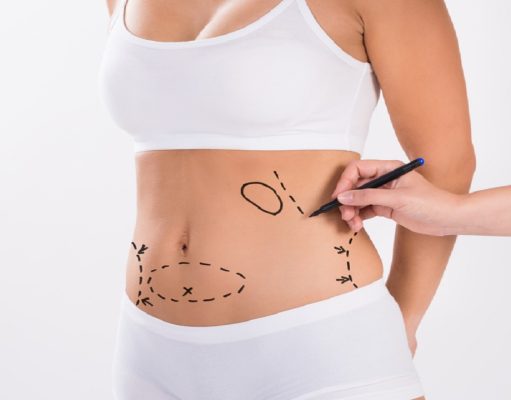 Effortless Elegance: Achieve Your Ideal Silhouette with Liposuction in Turkey Liposuction in Turkey
